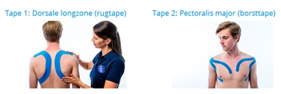 Medical taping hooikoorts